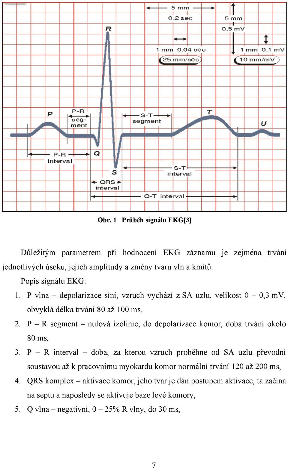 P R segment nulová izolinie, do depolarizace komor, doba trvání okolo 80 ms, 3.