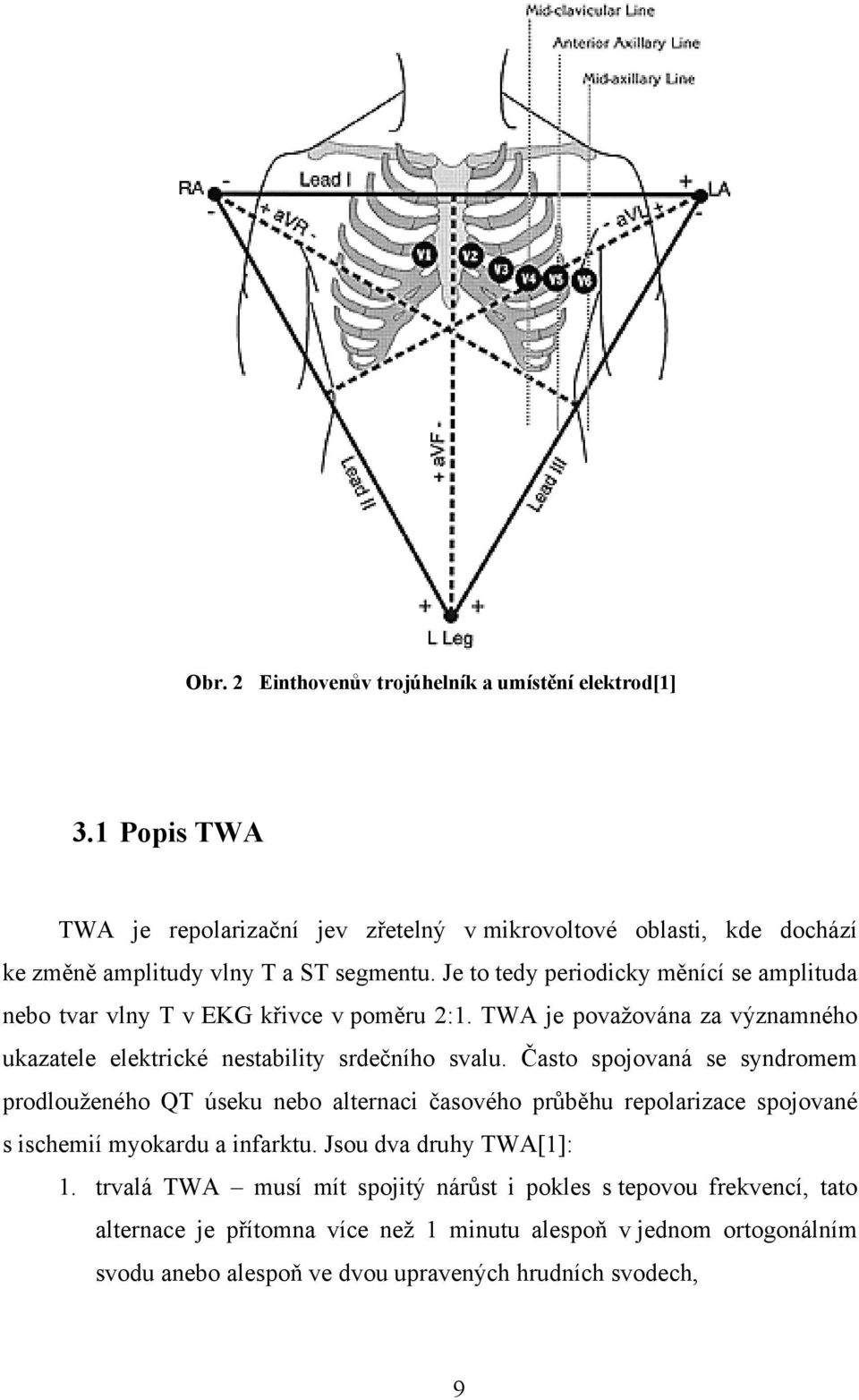 Často spojovaná se syndromem prodlouženého QT úseku nebo alternaci časového průběhu repolarizace spojované s ischemií myokardu a infarktu. Jsou dva druhy TWA[1]: 1.