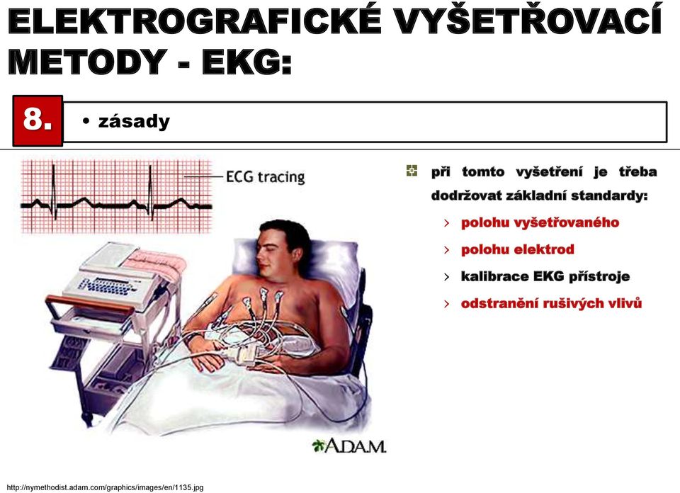 standardy: polohu vyšetřovaného polohu elektrod kalibrace EKG