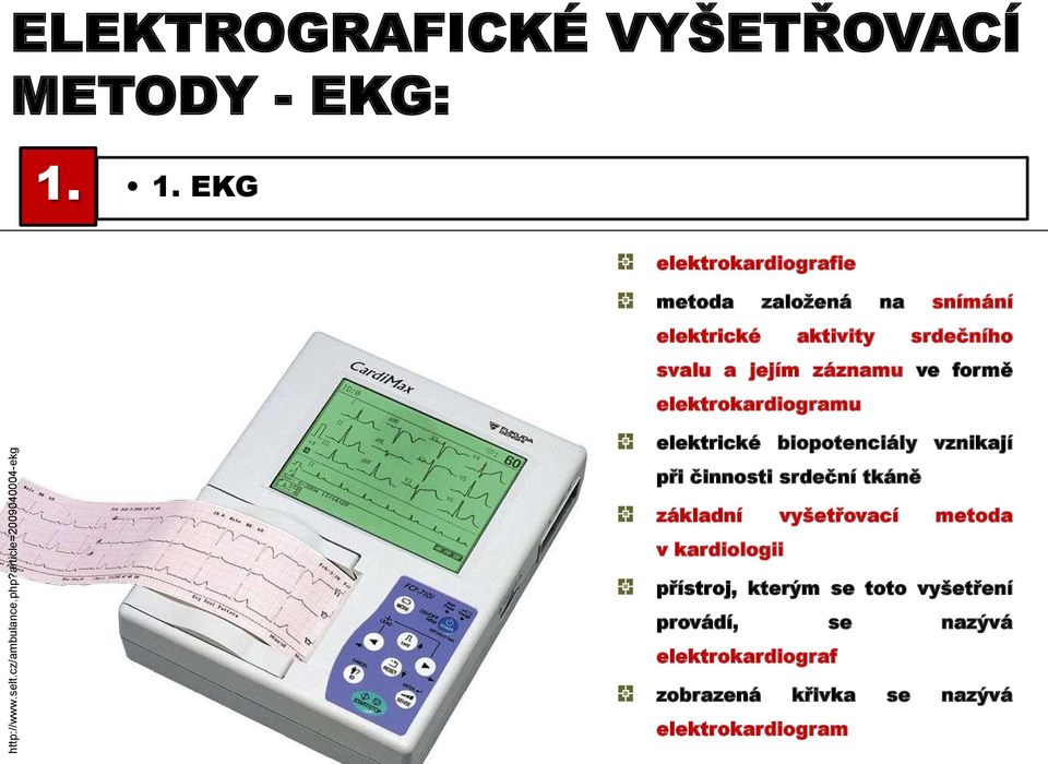 formě elektrokardiogramu elektrické biopotenciály vznikají při činnosti srdeční tkáně základní vyšetřovací metoda