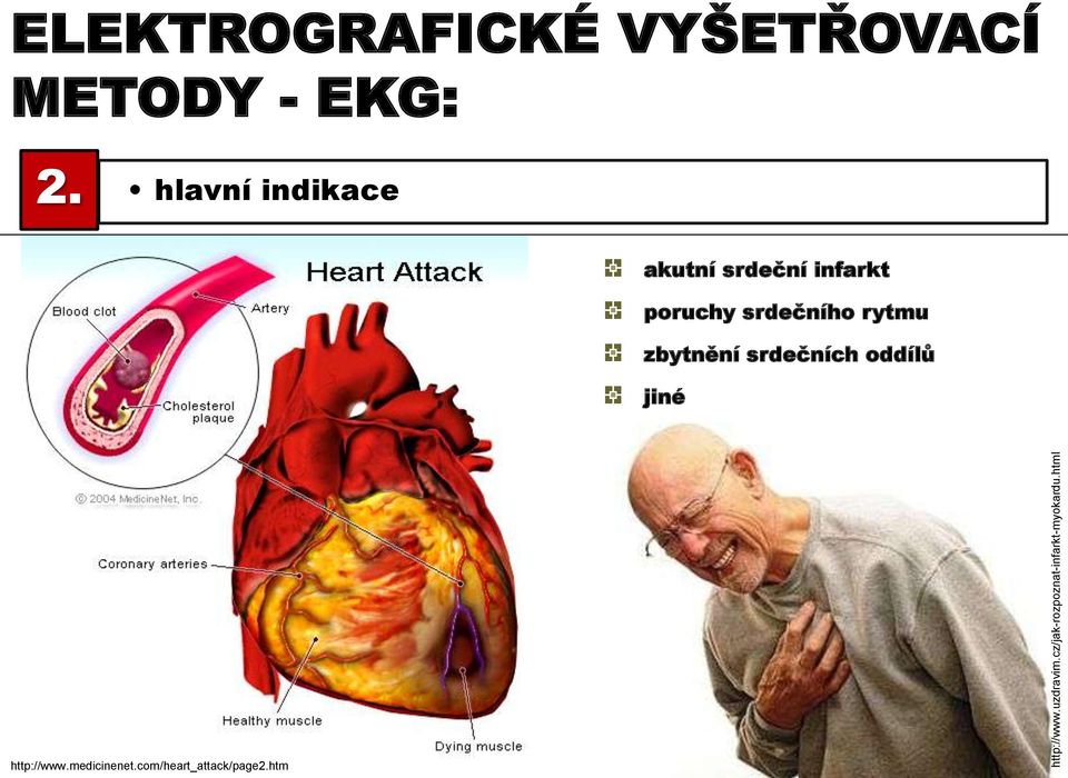 hlavní indikace akutní srdeční infarkt poruchy srdečního