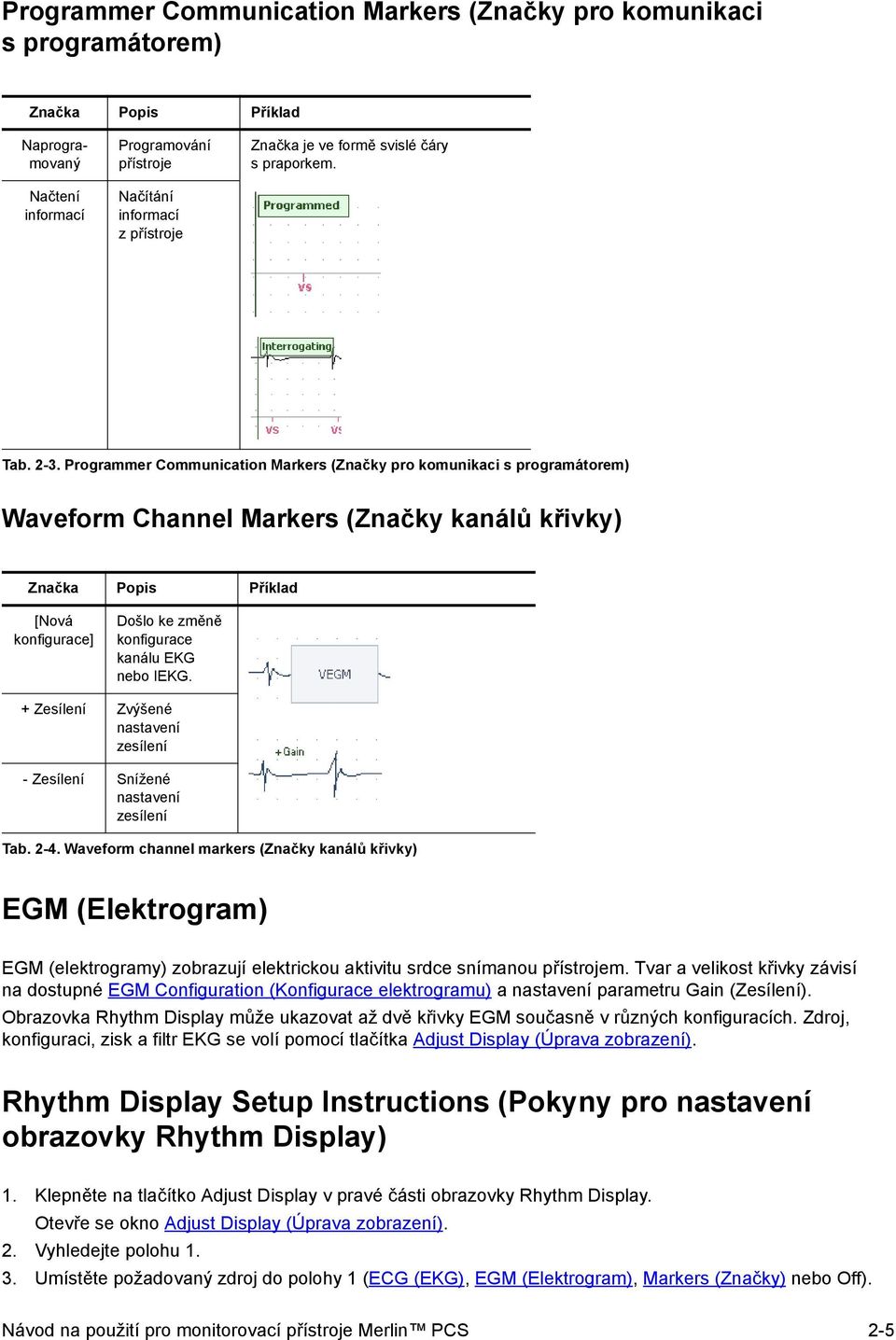 Programmer Communication Markers (Značky pro komunikaci s programátorem) Waveform Channel Markers (Značky kanálů křivky) Značka Popis Příklad [Nová konfigurace] Došlo ke změně konfigurace kanálu EKG