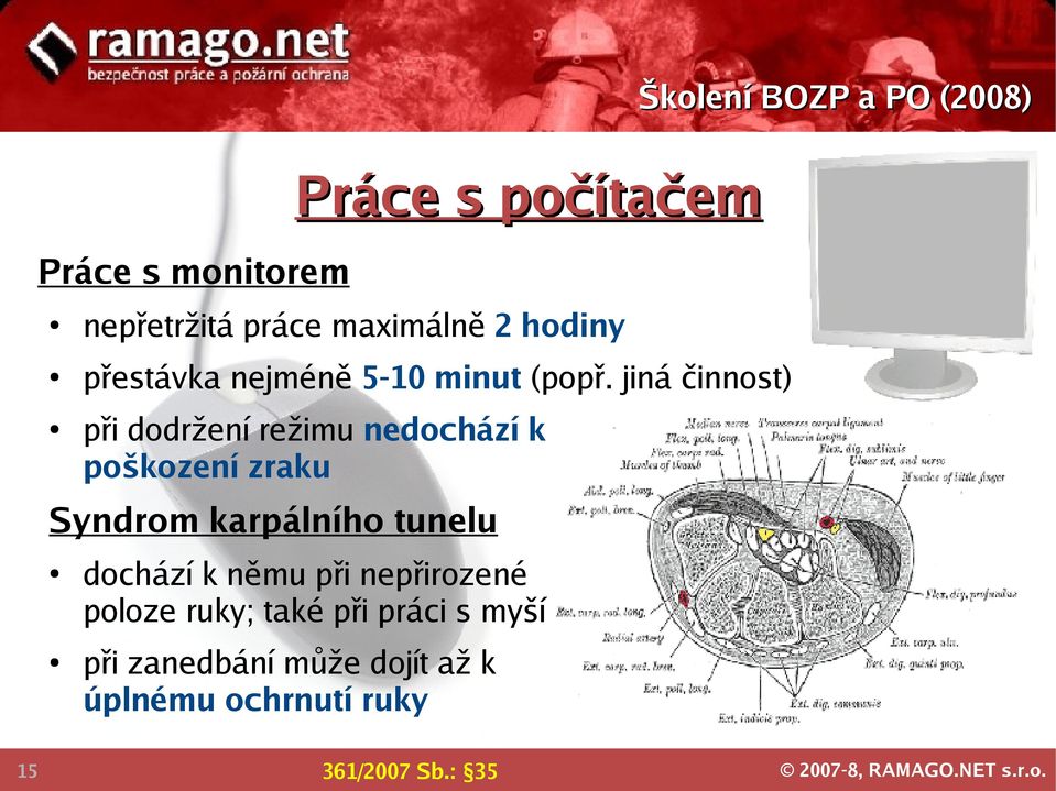 jiná činnost) při dodržení režimu nedochází k poškození zraku Syndrom karpálního