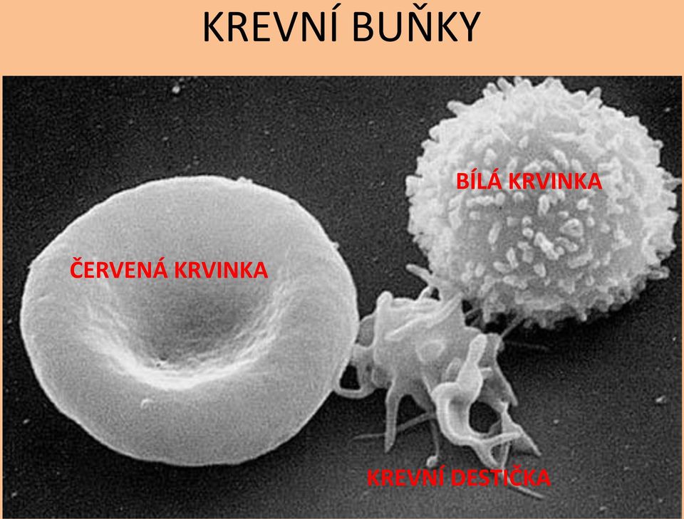 ČERVENÁ