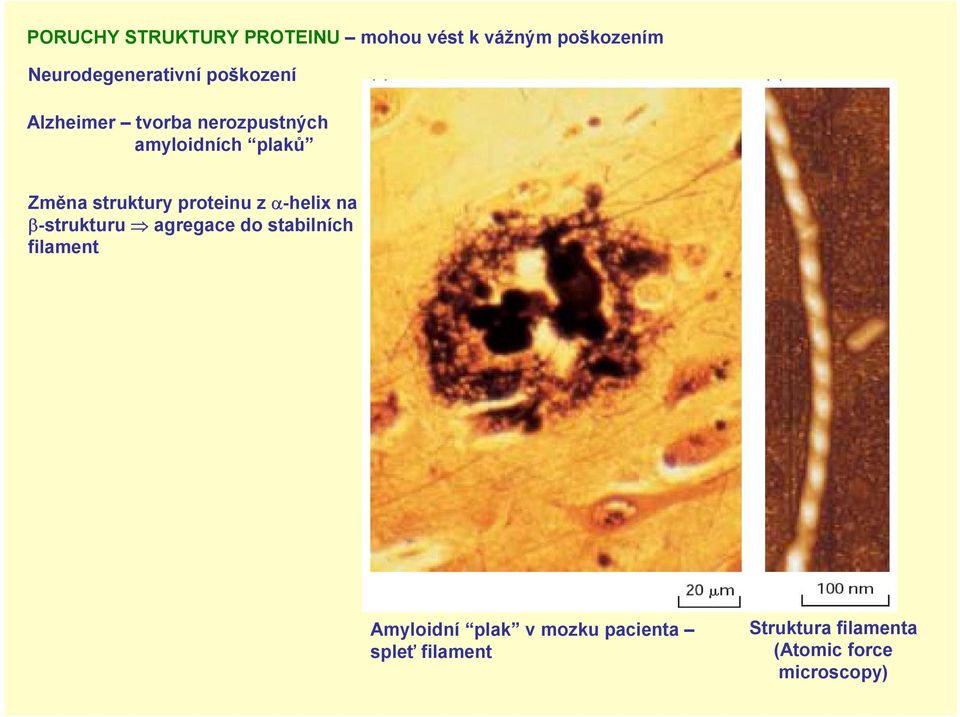 proteinu z α-helix na β-strukturu agregace do stabilních filament Amyloidní