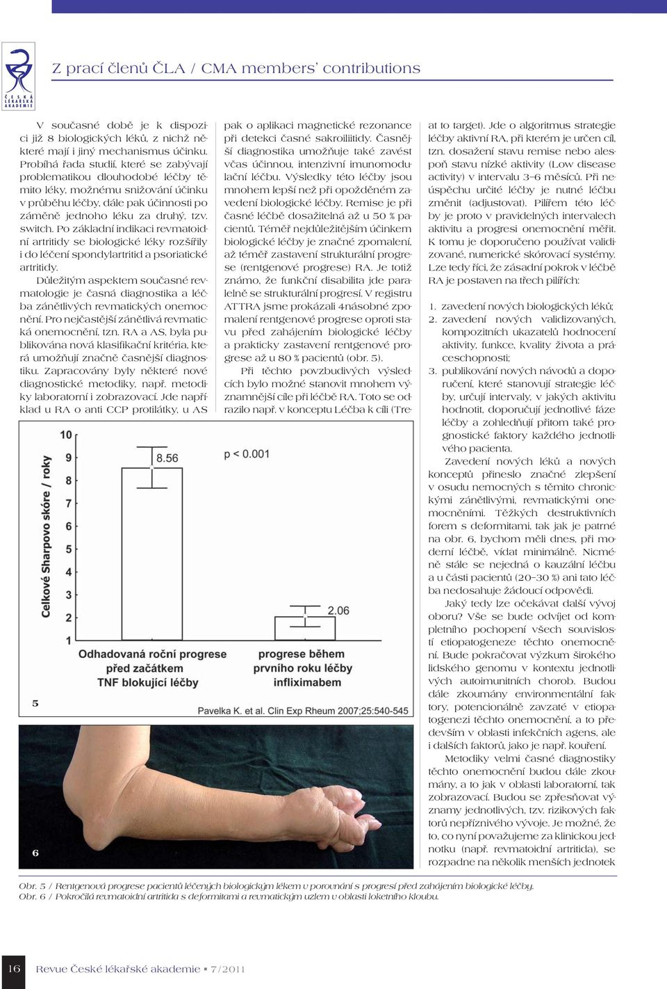 Po základní indikaci revmatoidní artritidy se biologické léky rozšířily i do léčení spondylartritid a psoriatické artritidy.