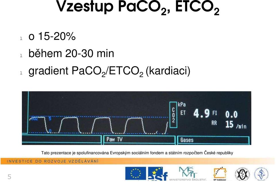 (kardiaci) Tat prezentace je splufinancvána