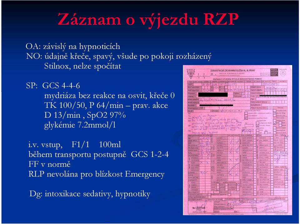 100/50, P 64/min prav.