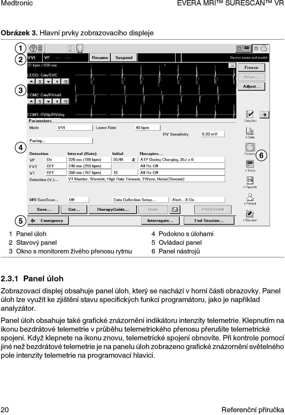 Klepnutím na ikonu bezdrátové telemetrie v průběhu telemetrického přenosu přerušíte telemetrické spojení. Když klepnete na ikonu znovu, telemetrické spojení obnovíte.