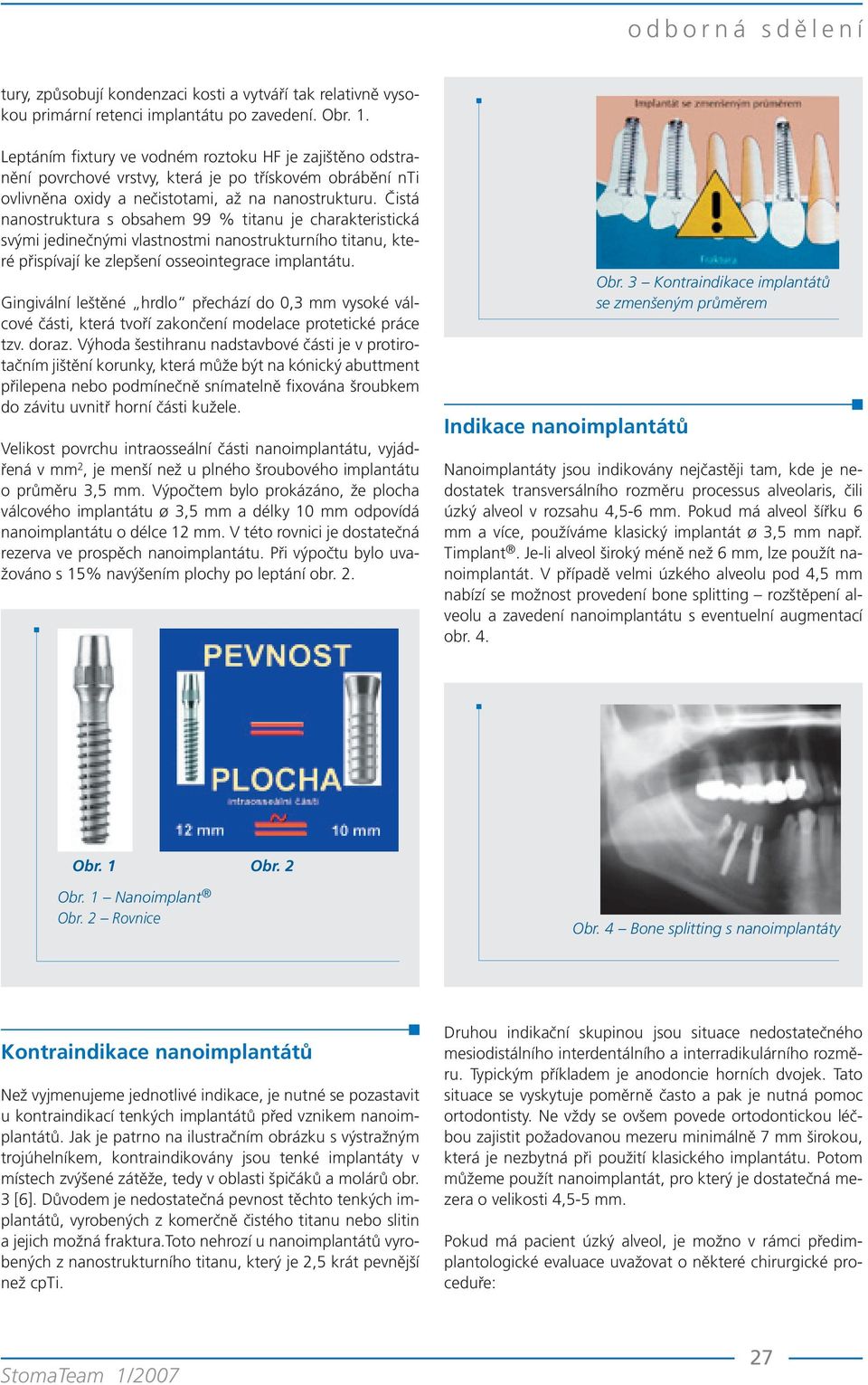 Čistá nanostruktura s obsahem 99 % titanu je charakteristická svými jedinečnými vlastnostmi nanostrukturního titanu, které přispívají ke zlepšení osseointegrace implantátu.