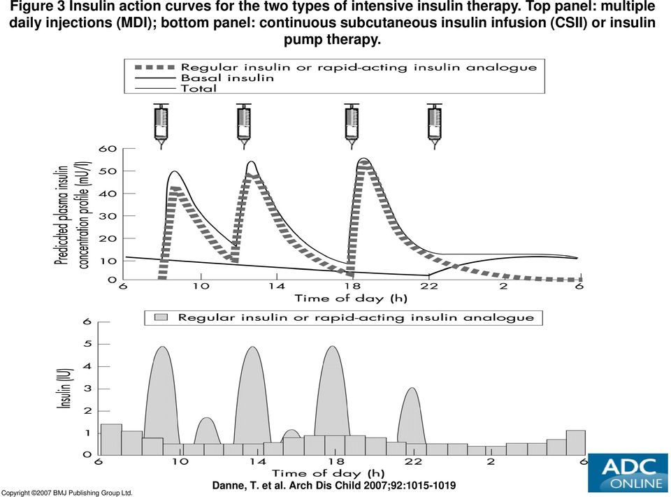 Top panel: multiple daily injections (MDI); bottom panel: continuous