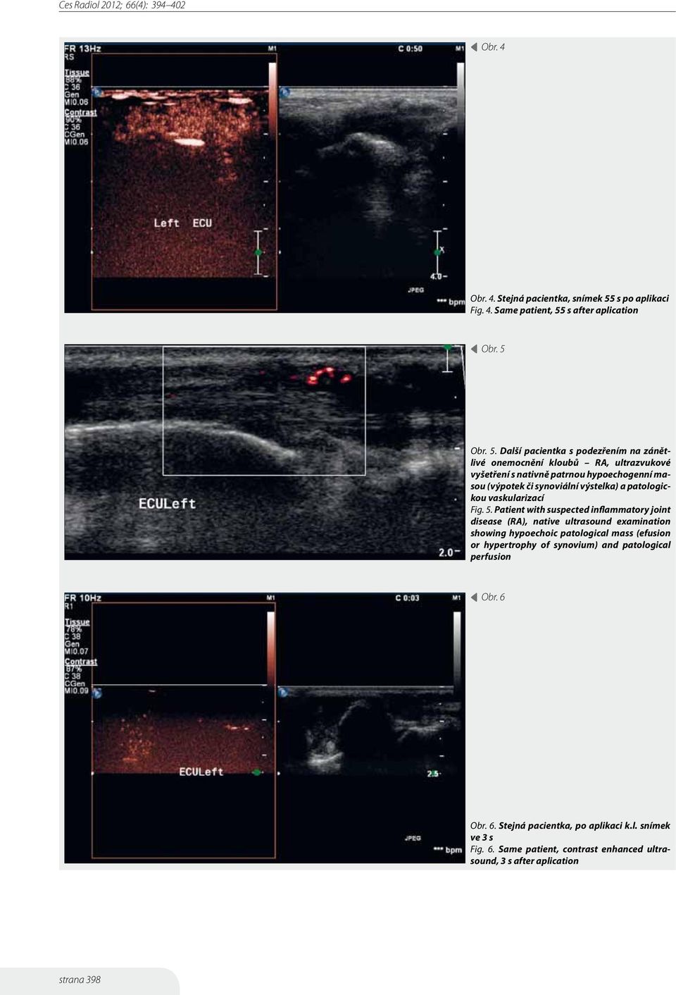 s after aplication Obr. 5 