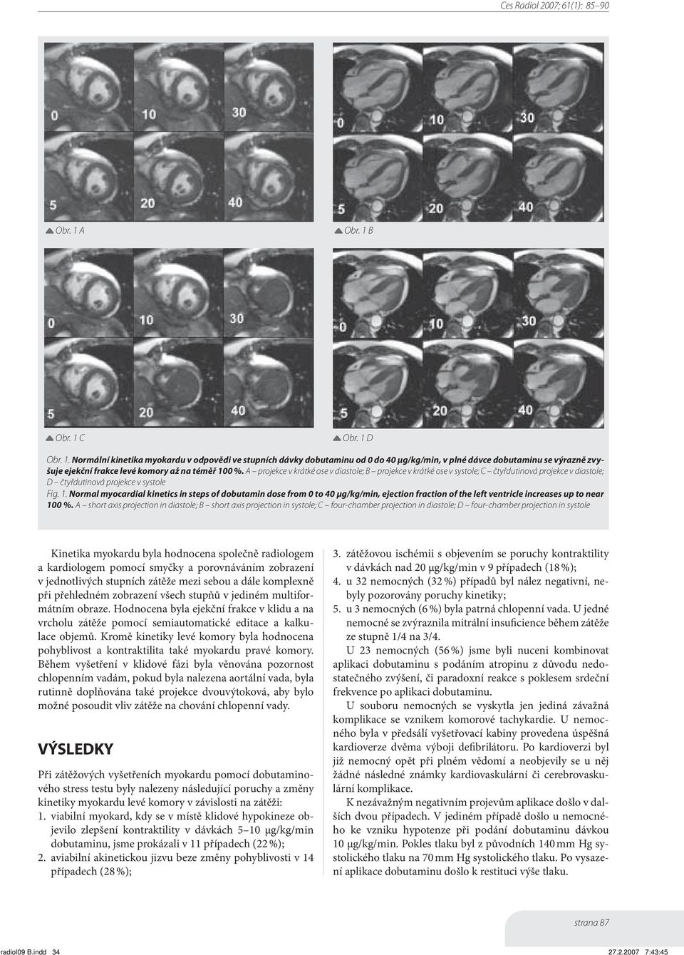 Normal myocardial kinetics in steps of dobutamin dose from 0 to 40 μg/kg/min, ejection fraction of the left ventricle increases up to near 100 %.