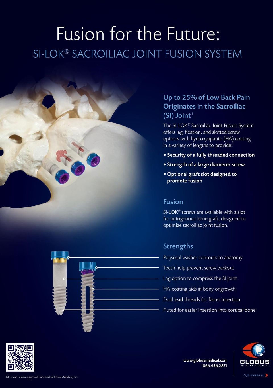 graft, designed to optimize sacroiliac joint fusion.