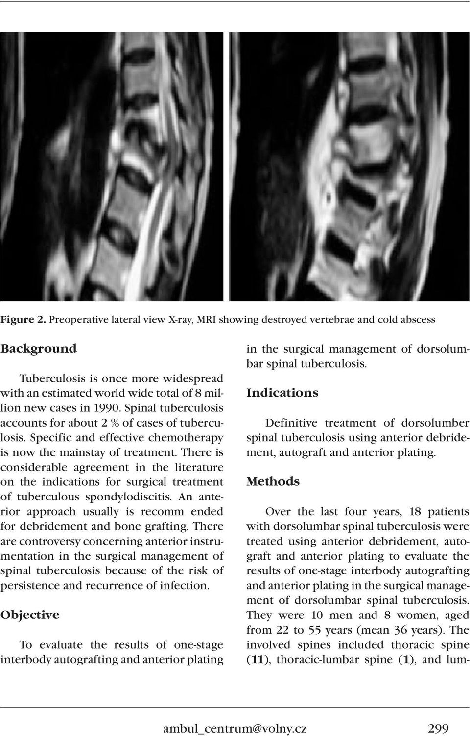 Spinal tuberculosis accounts for about 2 % of cases of tuberculosis. Specific and effective chemotherapy is now the mainstay of treatment.