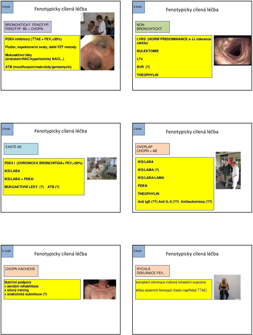 ) THEOPHYLIN ČASTÉ AE CHOPN + AB PDE4 i (CHRONICKÁ BRONCHITIDA+ FEV 1 <50%) IKS/LABA IKS/LABA + PDE4i MUKOAKTIVNÍ LÉKY (?) ATB (?) IKS/LABA IKS/LAMA (?