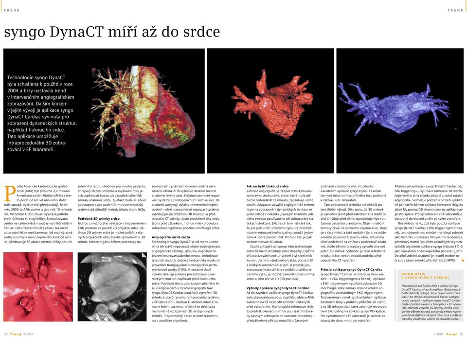 Tato aplikace umožňuje intraprocedurální 3D zobrazování v EF laboratoři.