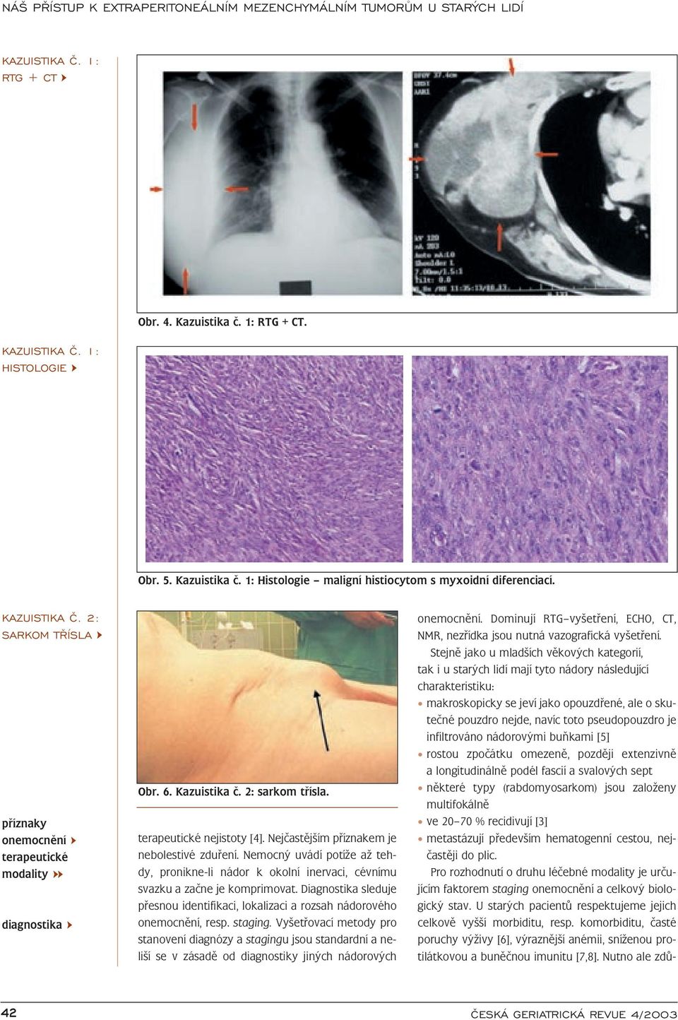 Nemocný uvádí potíže až tehdy, pronikne-li nádor k okolní inervaci, cévnímu svazku a začne je komprimovat. Diagnostika sleduje přesnou identifikaci, lokalizaci a rozsah nádorového onemocnění, resp.