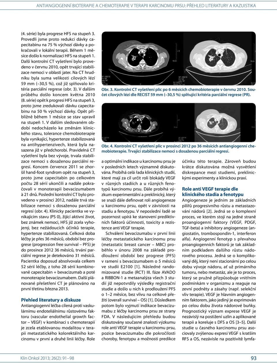 Na CT hrudníku byla suma velikosti cílových lézí 59 mm ( 30,5 %), což již splňovalo kritéria parciální regrese (obr. 3). V dalším průběhu došlo koncem května 2010 (8.