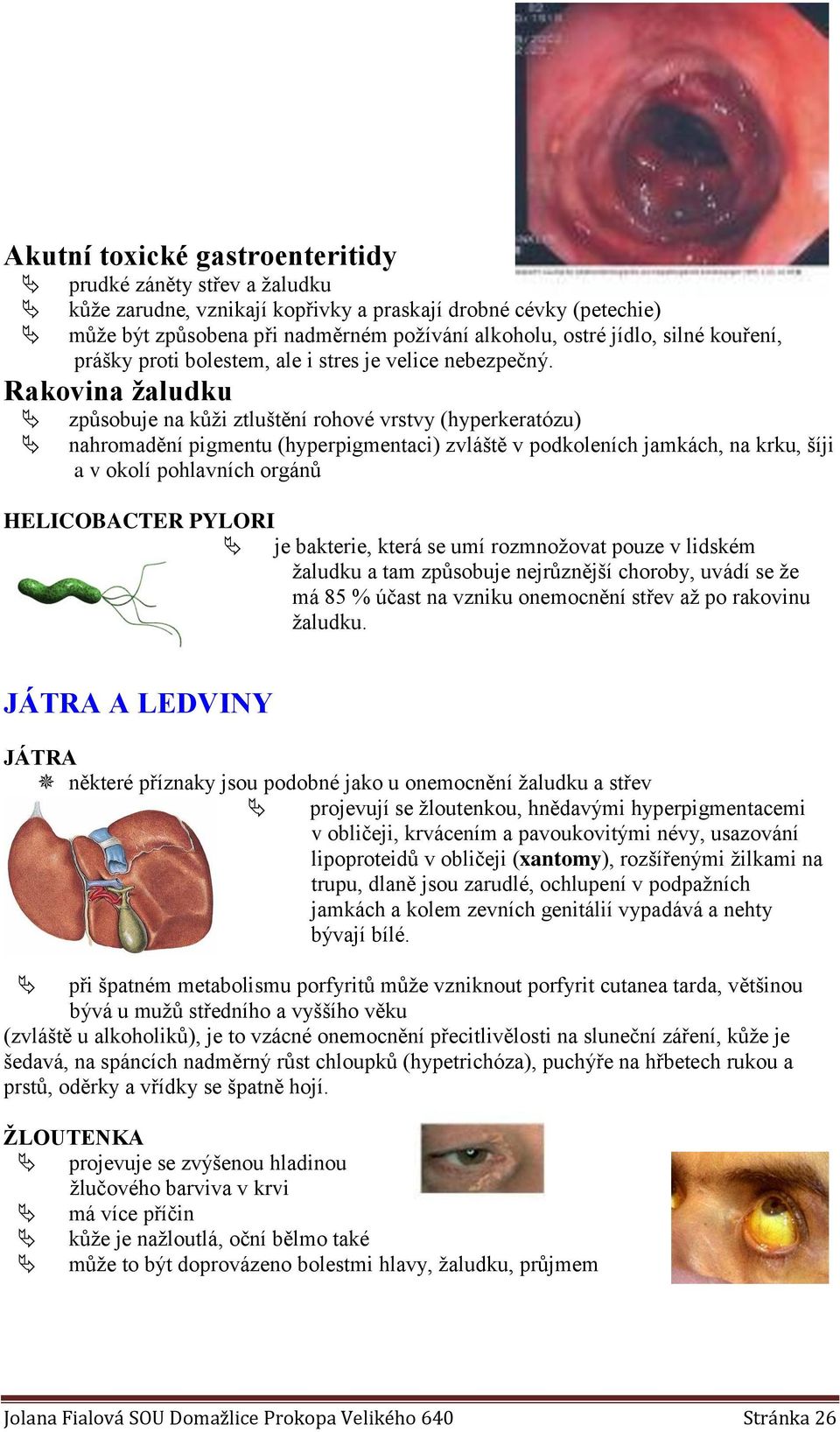 Rakovina žaludku způsobuje na kůži ztluštění rohové vrstvy (hyperkeratózu) nahromadění pigmentu (hyperpigmentaci) zvláště v podkoleních jamkách, na krku, šíji a v okolí pohlavních orgánů HELICOBACTER