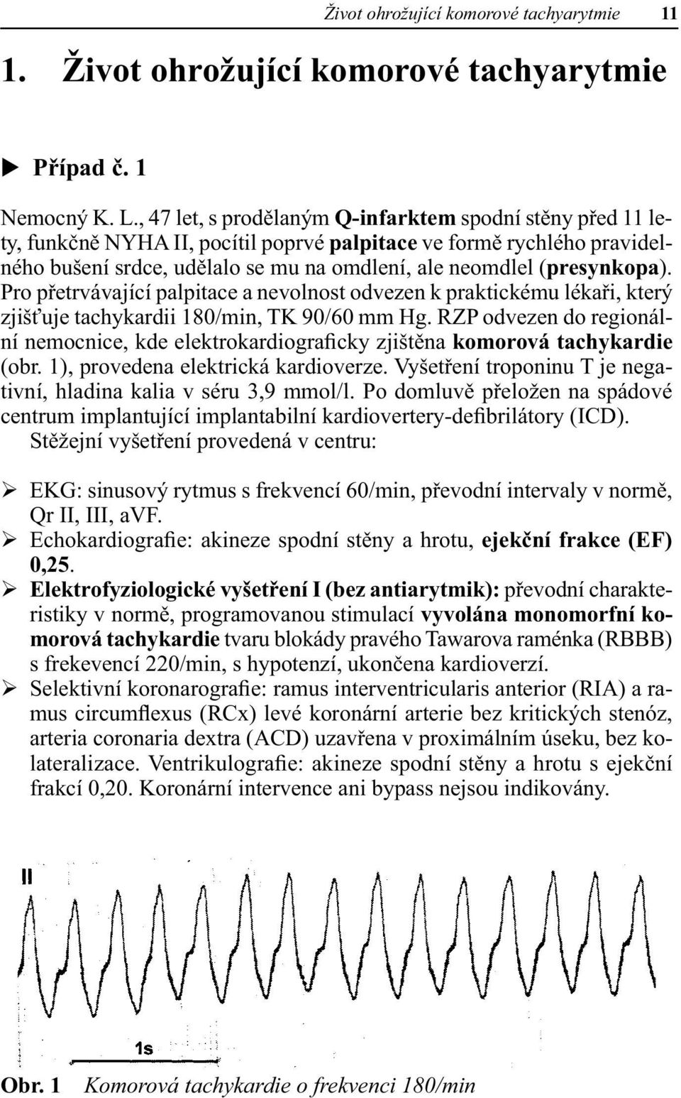 (presynkopa). Pro přetrvávající palpitace a nevolnost odvezen k praktickému lékaři, který zjišťuje tachykardii 180/min, TK 90/60 mm Hg.