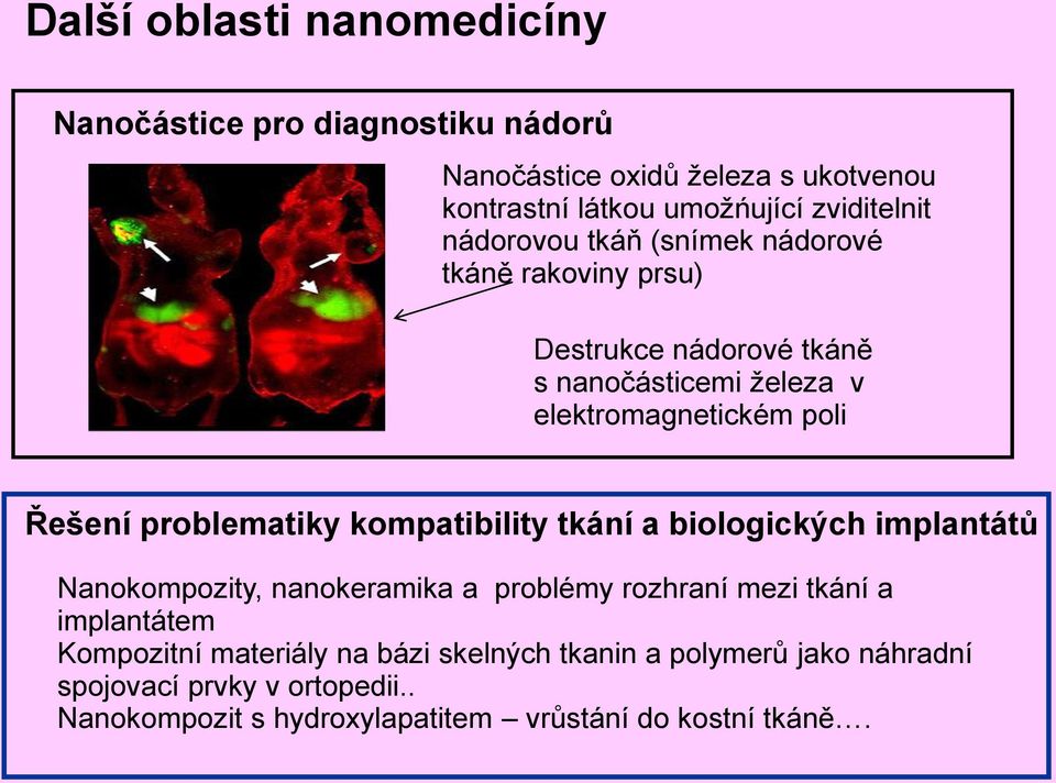 problematiky kompatibility tkání a biologických implantátů Nanokompozity, nanokeramika a problémy rozhraní mezi tkání a implantátem