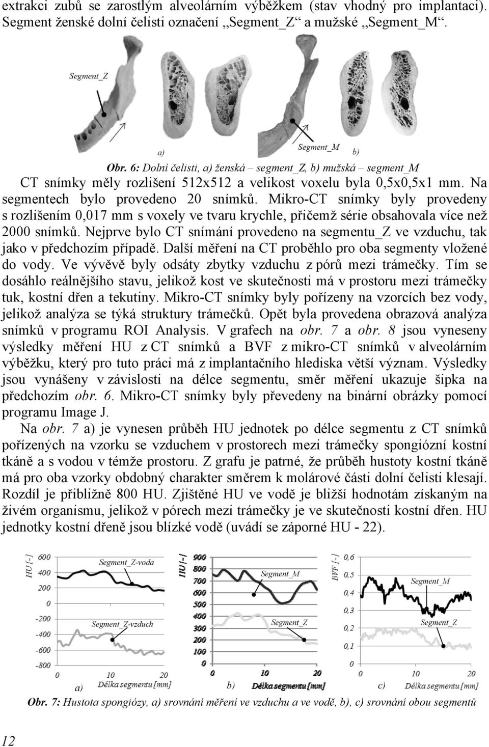 Mikro-CT snímky byly provedeny s rozlišením 0,017 mm s voxely ve tvaru krychle, přičemž série obsahovala více než 2000 snímků.