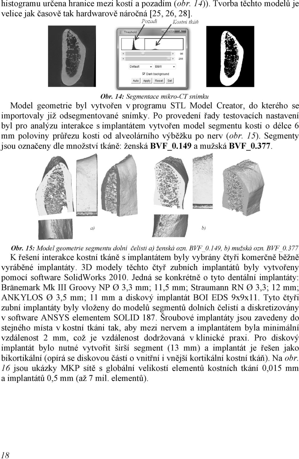 Po provedení řady testovacích nastavení byl pro analýzu interakce s implantátem vytvořen model segmentu kosti o délce 6 mm poloviny průřezu kosti od alveolárního výběžku po nerv (obr. 15).