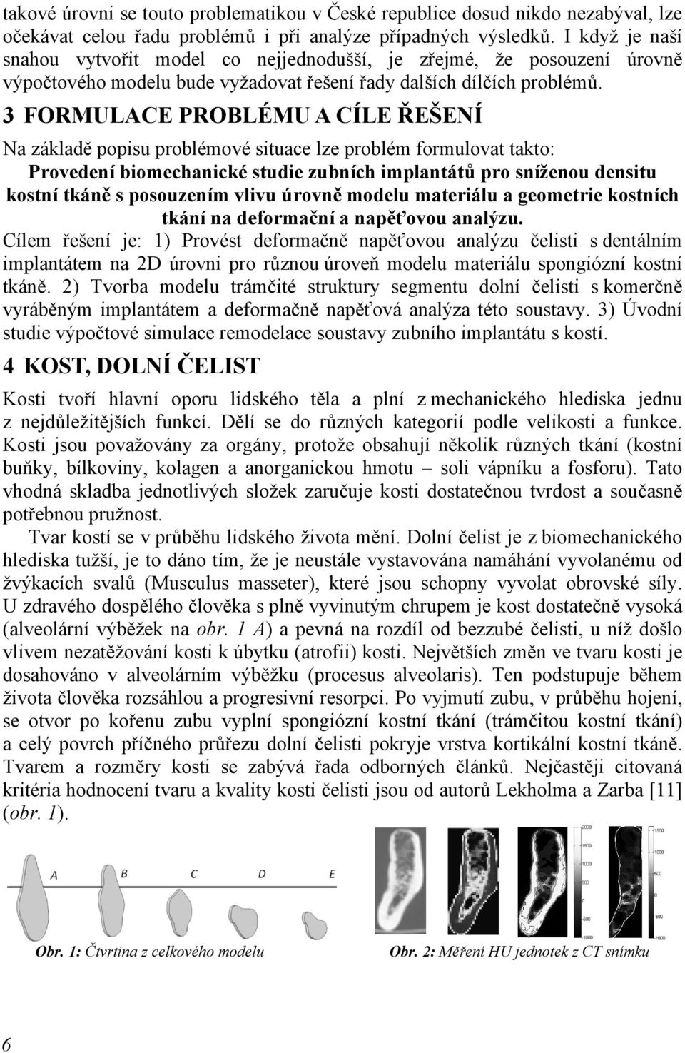 3 FORMULACE PROBLÉMU A CÍLE ŘEŠENÍ Na základě popisu problémové situace lze problém formulovat takto: Provedení biomechanické studie zubních implantátů pro sníženou densitu kostní tkáně s posouzením