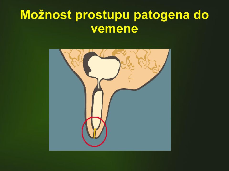 patogena