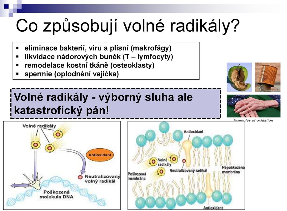 nádorových buněk (T lymfocyty) remodelace kostní tkáně