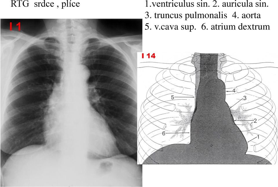 auricula sin. 3.