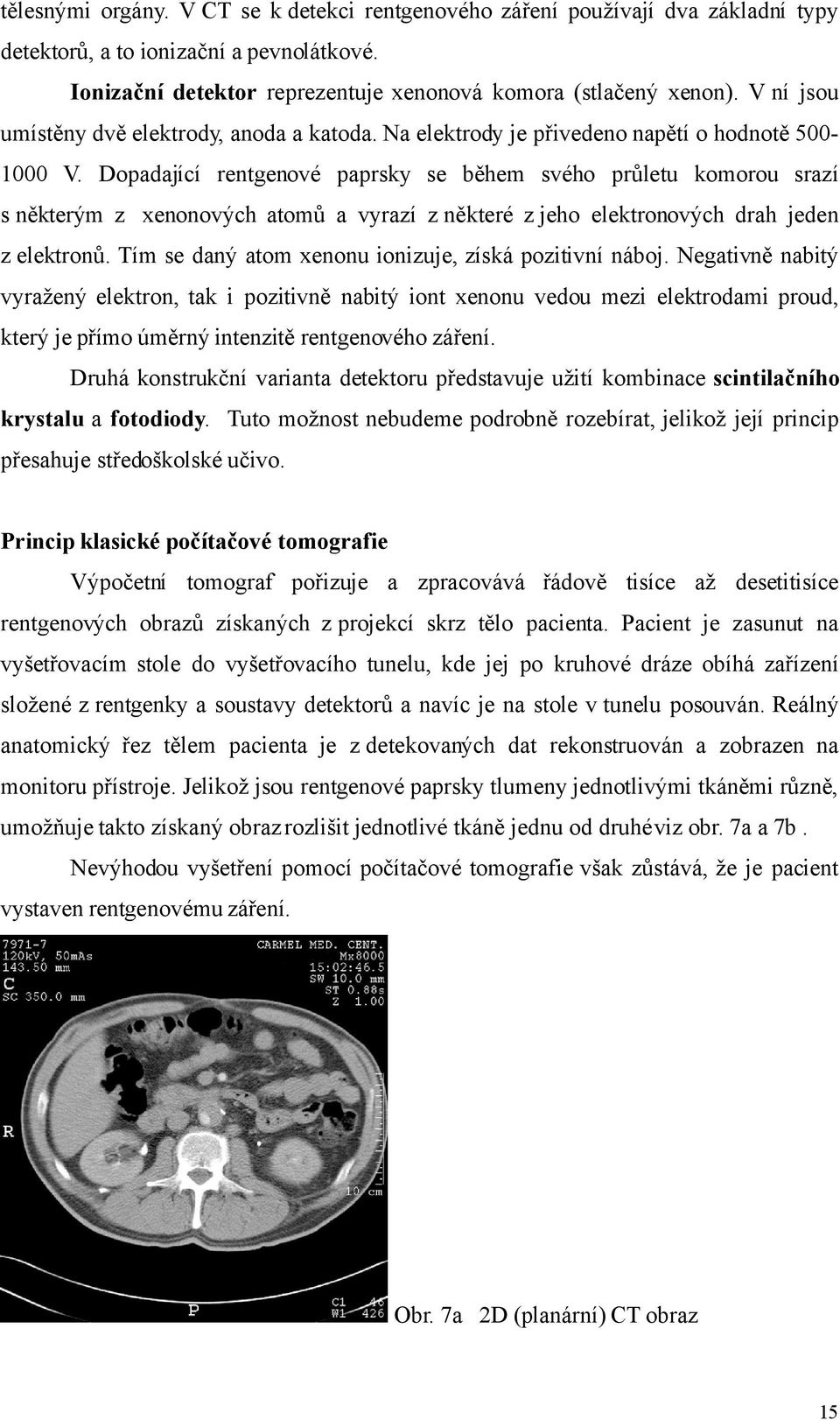 Dopadající rentgenové paprsky se během svého průletu komorou srazí s některým z xenonových atomů a vyrazí z některé z jeho elektronových drah jeden z elektronů.