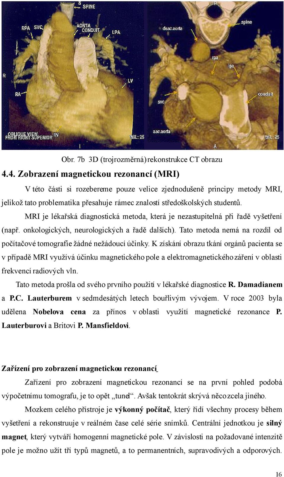 MRI je lékařská diagnostická metoda, která je nezastupitelná při řadě vyšetření (např. onkologických, neurologických a řadě dalších).