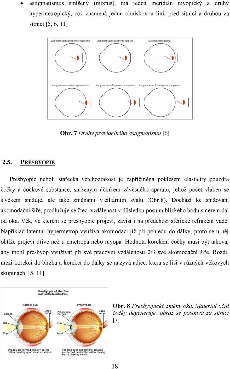 PRESBYOPIE Presbyopie neboli stařecká vetchozrakost je zapříčiněna poklesem elasticity pouzdra čočky a čočkové substance, sníženým účinkem závěsného aparátu, jehož počet vláken se s věkem snižuje,