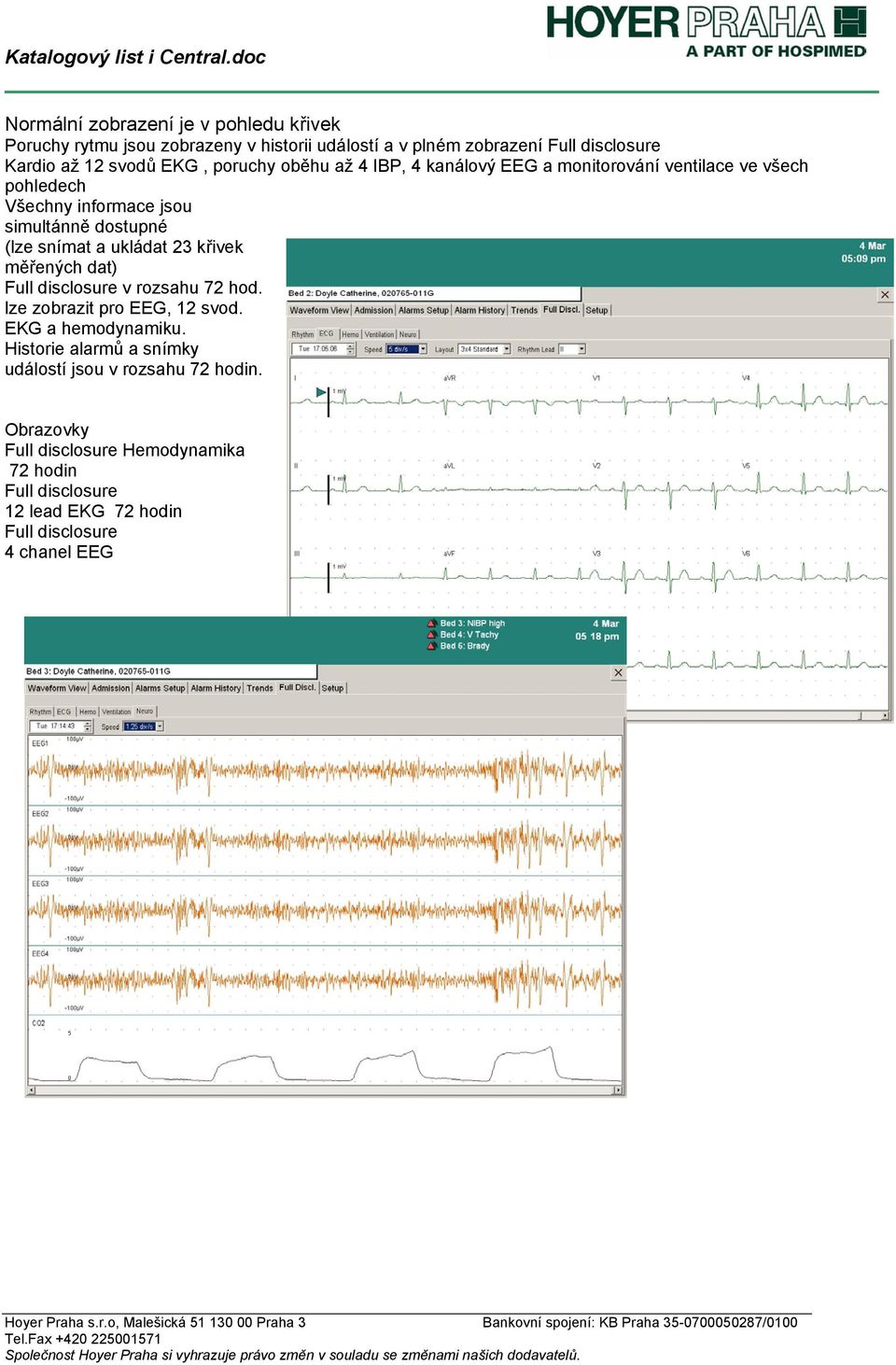 ukládat 23 křivek měřených dat) Full disclosure v rozsahu 72 hod. lze zobrazit pro EEG, 12 svod. EKG a hemodynamiku.