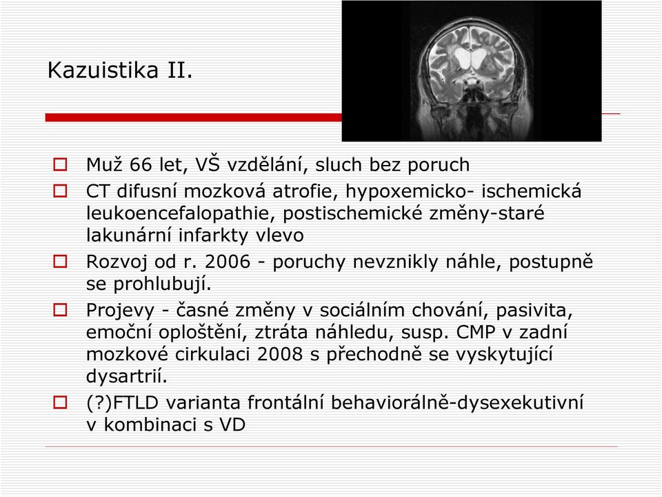 postischemické změny-staré lakunární infarkty vlevo Rozvoj od r. 2006 - poruchy nevznikly náhle, postupně se prohlubují.