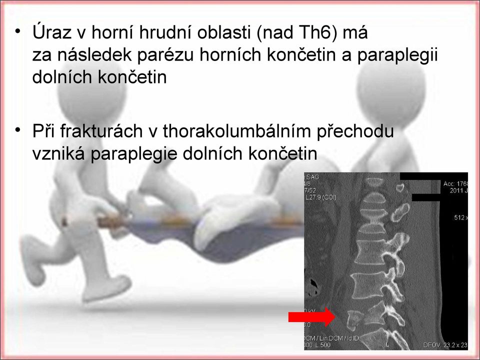 dolních končetin Při frakturách v