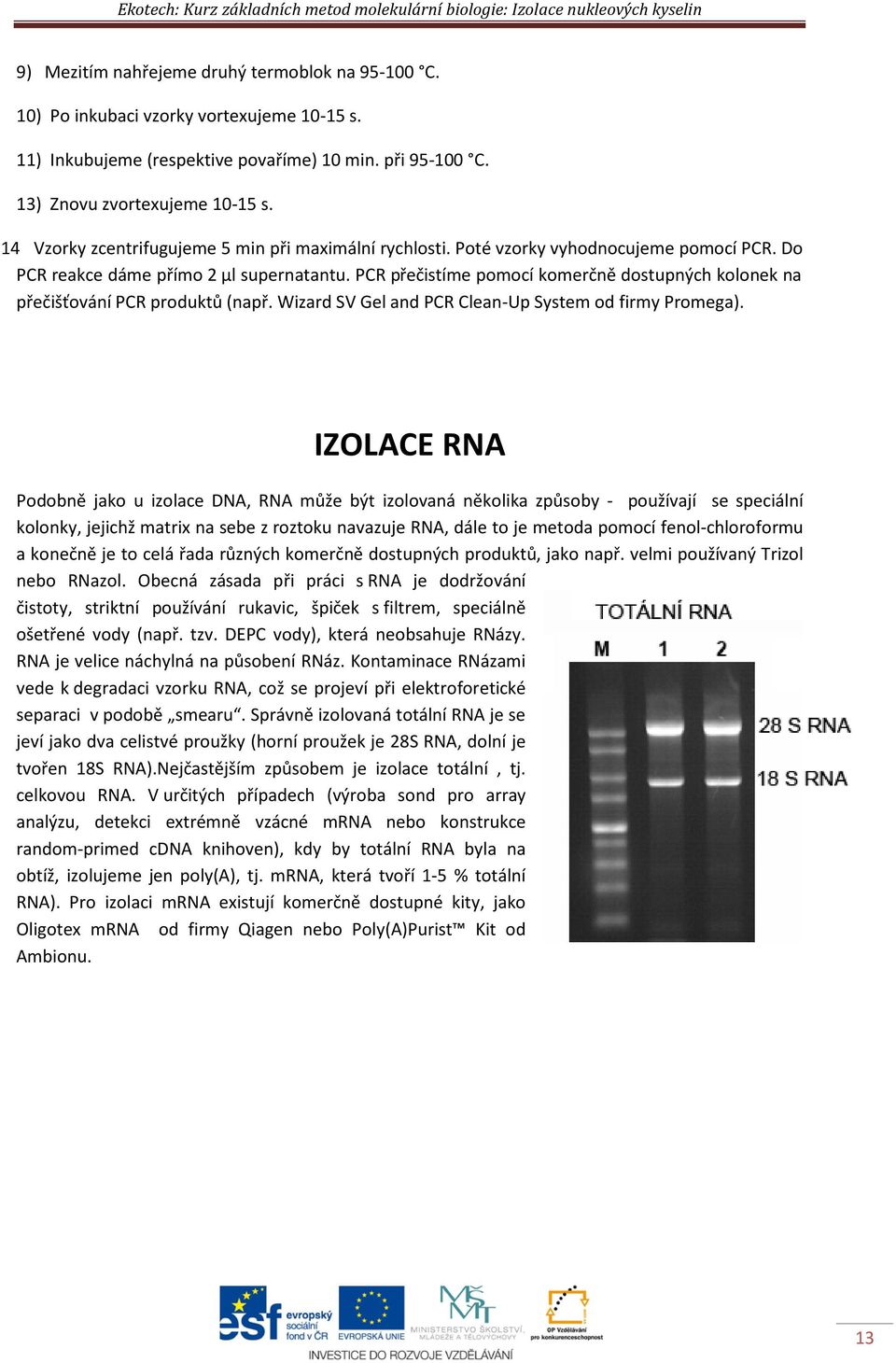 Do PCR reakce dáme přímo 2 μl supernatantu. PCR přečistíme pomocí komerčně dostupných kolonek na přečišťování PCR produktů (např. Wizard SV Gel and PCR Clean-Up System od firmy Promega).