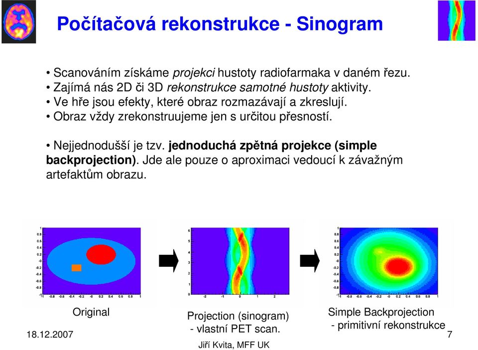 Obraz vždy zrekonstruujeme jen s určitou přesností. Nejjednodušší je tzv. jednoduchá zpětná projekce (simple backprojection).