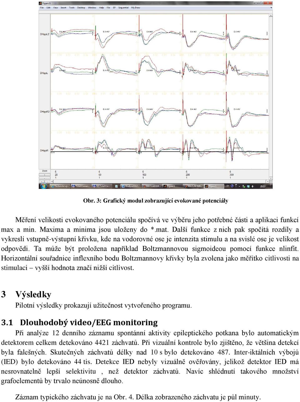 Ta může být proložena například Boltzmannovou sigmoideou pomocí funkce nlinfit.