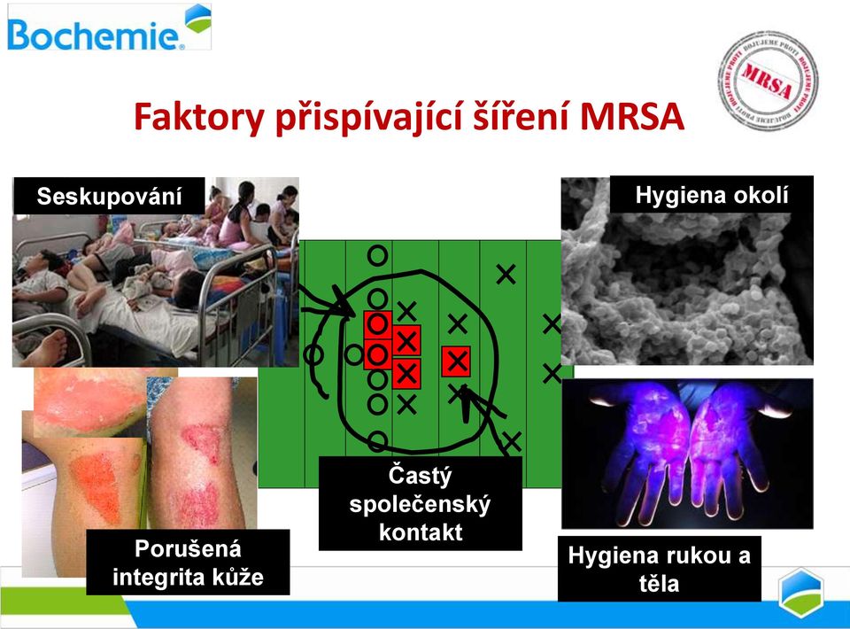 Porušená integrita kůže Častý