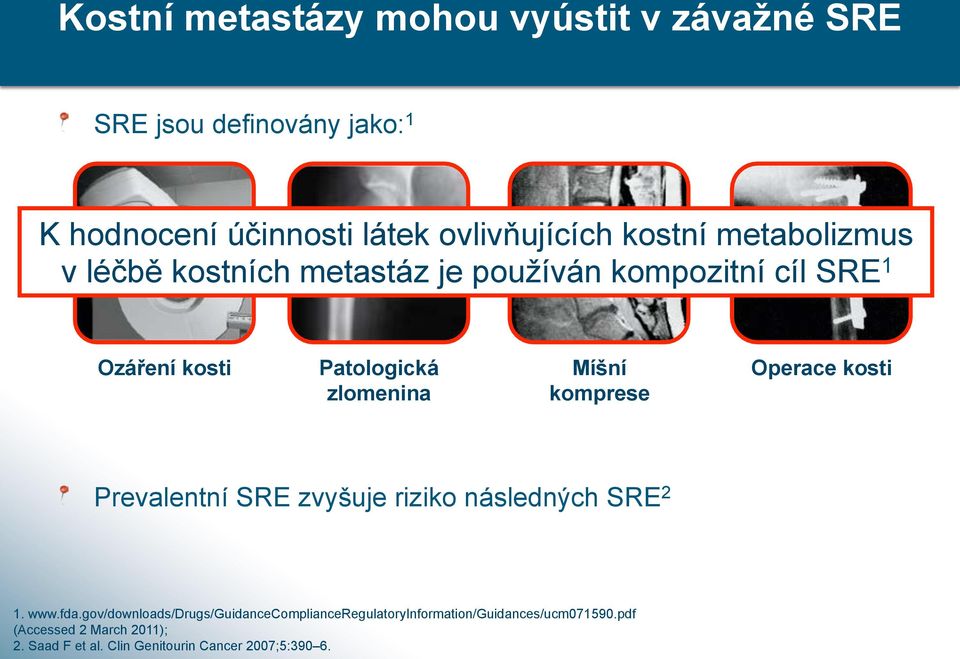 pou!íván kompozitní cíl SRE 1 Ozá%ení kosti Patologická zlomenina Mí&ní komprese Operace kosti!