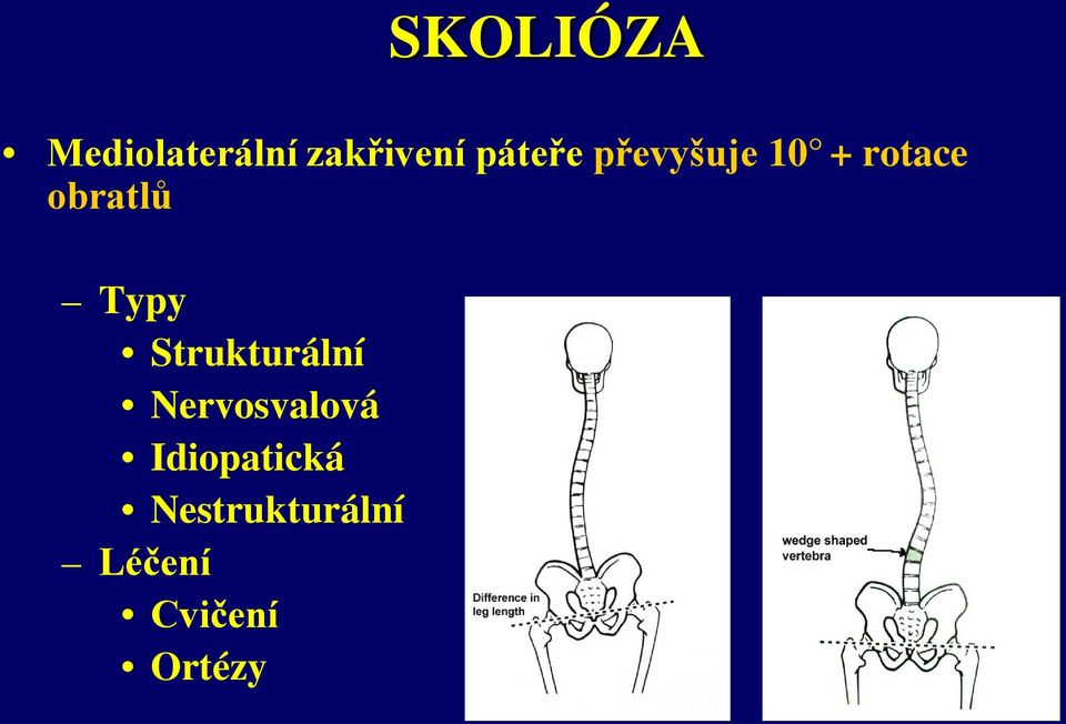 Strukturální Nervosvalová Idiopatická