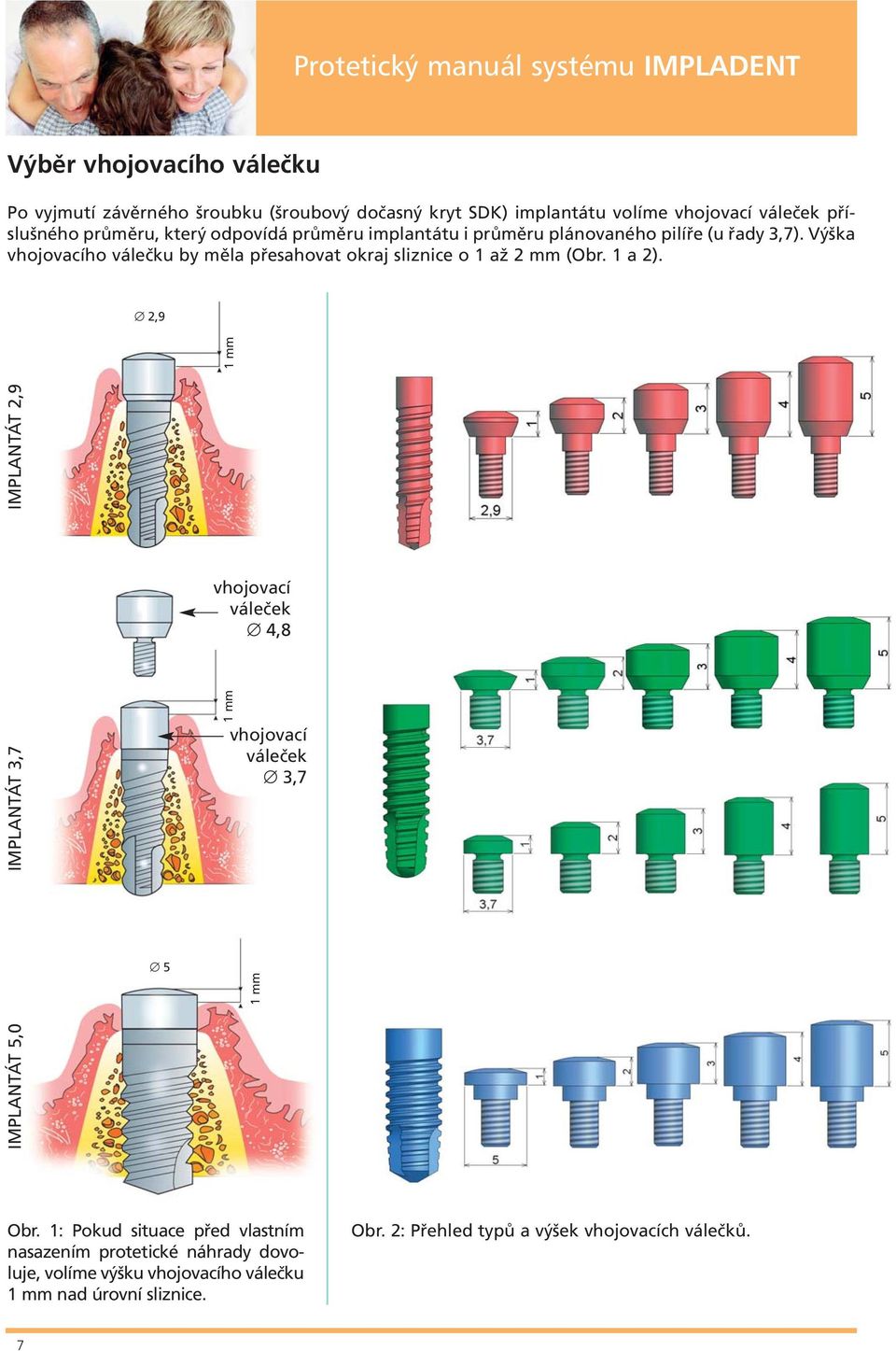 1 a 2). 2,9 vhojovací váleček 4,8 IMPLANTÁT 3,7 1 mm 5 IMPLANTÁT 5,0 IMPLANTÁT 2,9 1 mm vhojovací váleček 3,7 1 mm Obr.