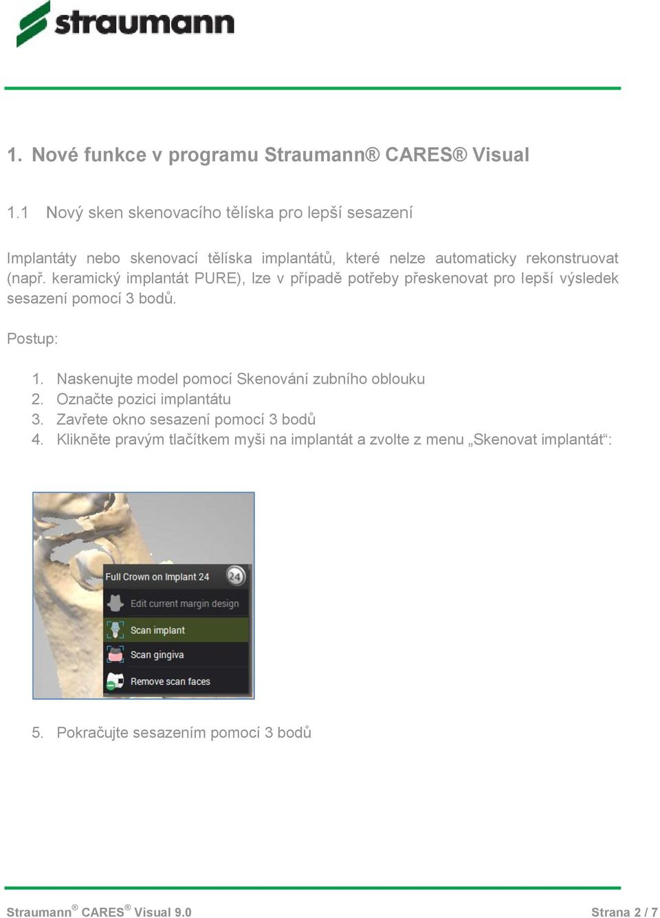 keramický implantát PURE), lze v případě potřeby přeskenovat pro lepší výsledek sesazení pomocí 3 bodů. Postup: 1.