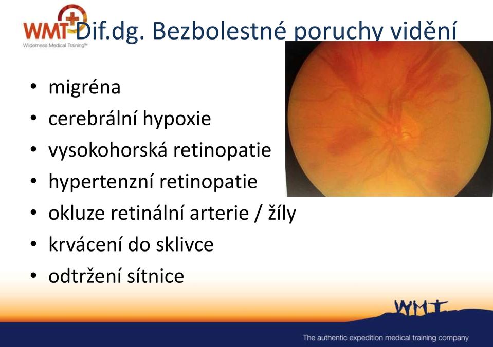 cerebrální hypoxie vysokohorská retinopatie