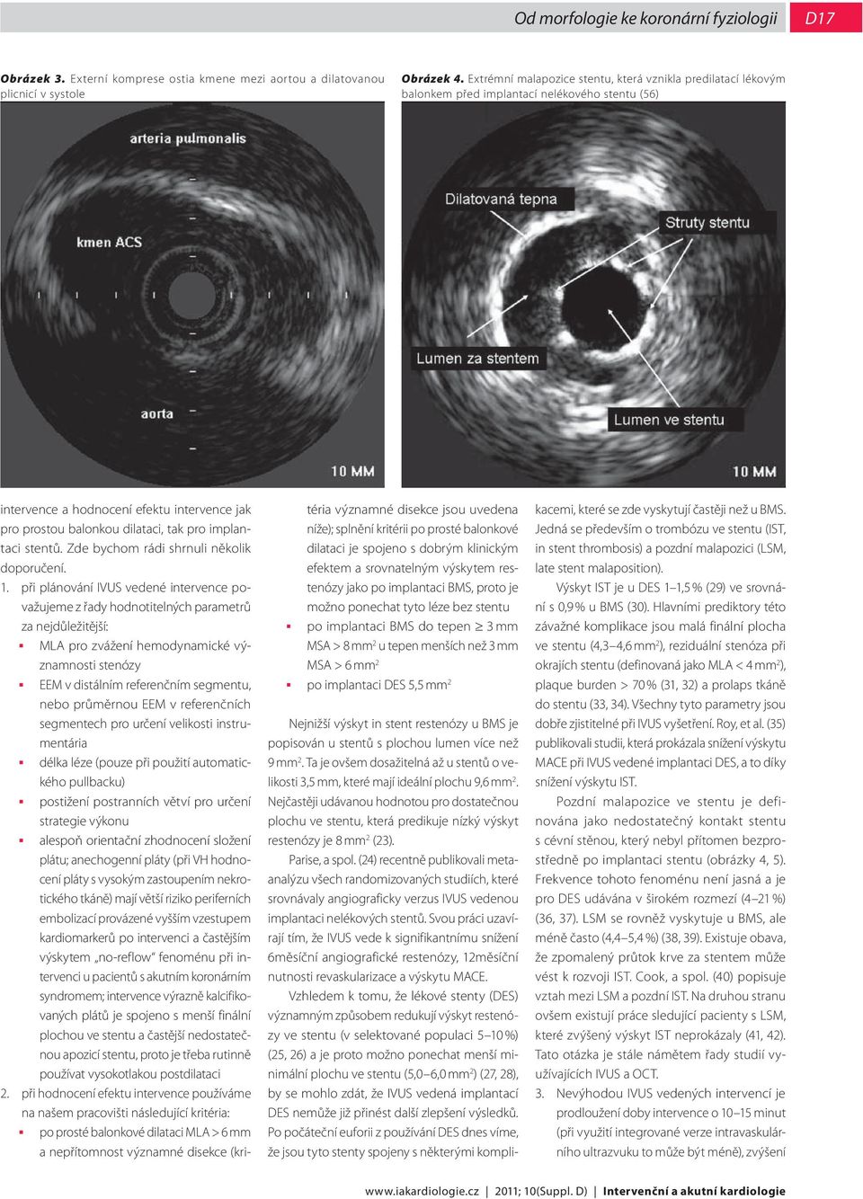 implantaci stentů. Zde bychom rádi shrnuli několik doporučení. 1.