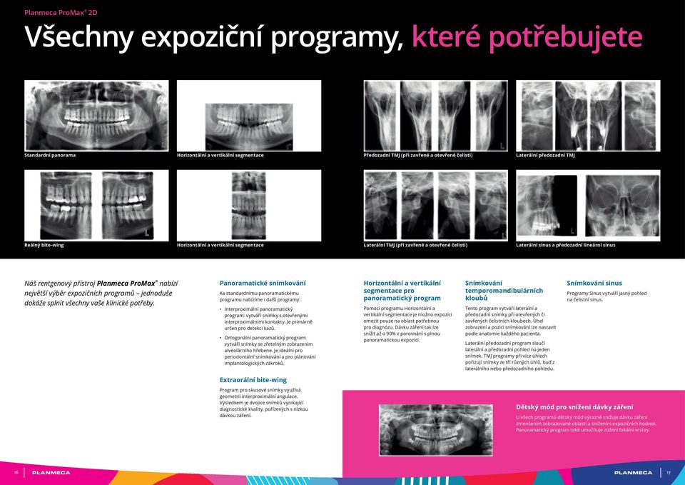 největší výběr expozičních programů jednoduše dokáže splnit všechny vaše klinické potřeby.