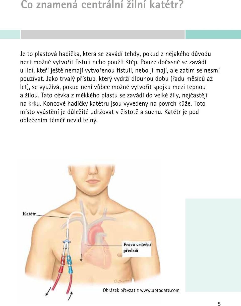 Jako trvalý přístup, který vydrží dlouhou dobu (řadu měsíců až let), se využívá, pokud není vůbec možné vytvořit spojku mezi tepnou a žílou.